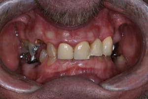 Img 5229 ypplf9 - Eugenol