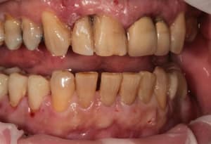 Img 5446 ltfokb - Eugenol