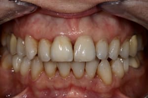 Img 5974 bnfkxb - Eugenol