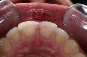 Img 6029  large  ne49c4 - Eugenol