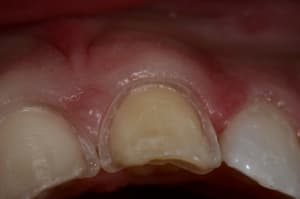 Img 6419 obyvhf - Eugenol