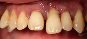 Img 6429 dtlngb - Eugenol