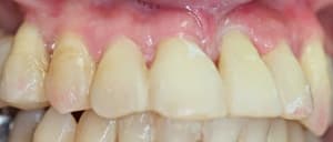 Img 6483 v4l7ej - Eugenol