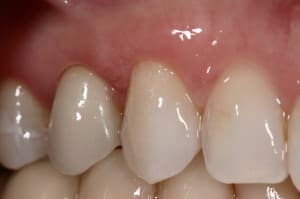 Img 6833 q3ahob - Eugenol