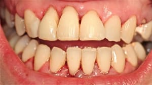 Img 6841 ya8pbj - Eugenol