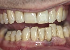 Img 7412 qyuflj - Eugenol