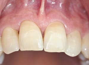 Img 7484 joysfd - Eugenol