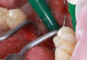Img 7523r oqheto - Eugenol