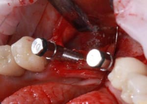 Img 7538r odwm7f - Eugenol