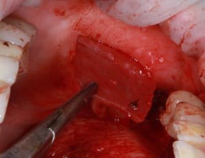 Img 7563r bzx7ln - Eugenol