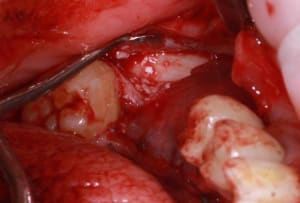 Img 7564r ahqod0 - Eugenol