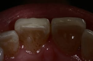 Img 7607 il9k29 - Eugenol