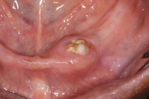 Img 7822 ei1lmg - Eugenol