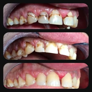 Img 8075 cpqy2r - Eugenol