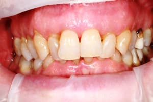 Img 8760 x1kr6n - Eugenol