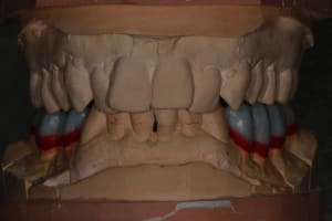 Img 8783 kpjfla - Eugenol