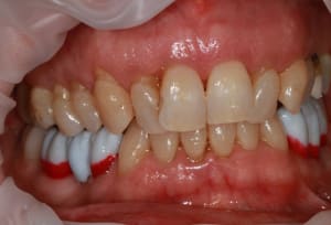 Img 8795 n6tqr2 - Eugenol