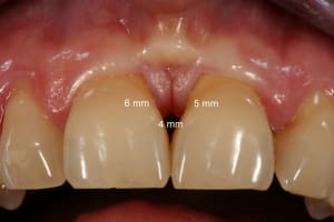Img 9043 1 zfpqf8 - Eugenol