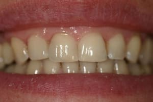 Img 95592 wgeu7j - Eugenol