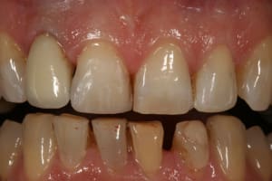 Img 9763 ncmpiz - Eugenol