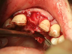 Img 9942 t6lzr9 - Eugenol