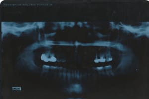 Img nvi4ox - Eugenol