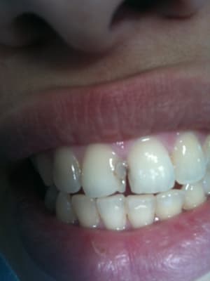 Iphone 067 zme5xa - Eugenol