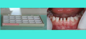 Image 1 ecpvuy - Eugenol