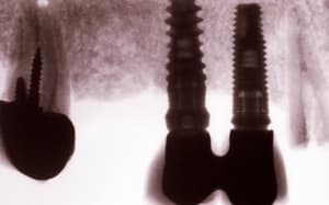 Image0001 qbyvhl - Eugenol