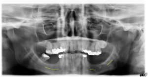 Image000 qxmkne - Eugenol