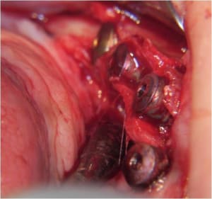 Image12 pqfnyv - Eugenol