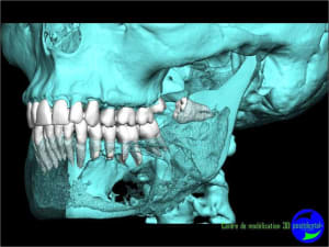 Image13 zwnu5z - Eugenol