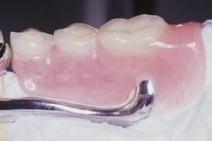 Image1 pvs0vu - Eugenol