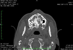 Image1 re07sv - Eugenol