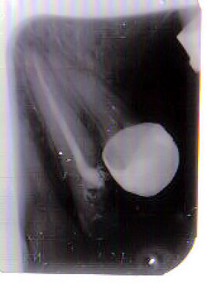 Image1 zmxpil - Eugenol