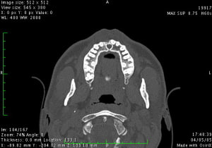 Image2 bipeqb - Eugenol