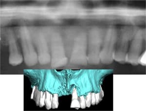 Image2 ntvvgo - Eugenol