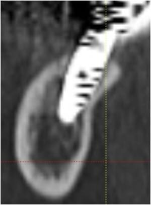 Image2r yr7csn - Eugenol