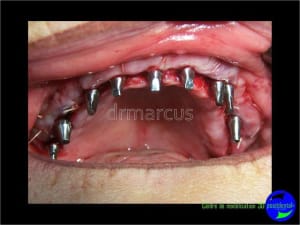 Image35 qjshmw - Eugenol