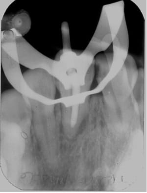 Image3 rrnjzu - Eugenol