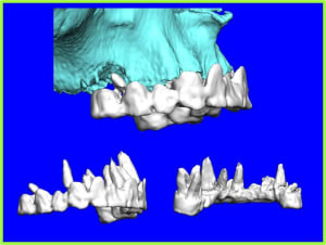 Image3 vgpjt9 - Eugenol