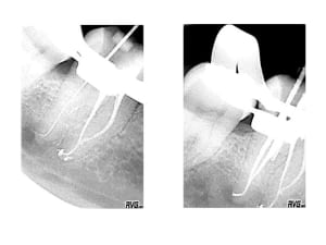 Image4 o5wzsp - Eugenol