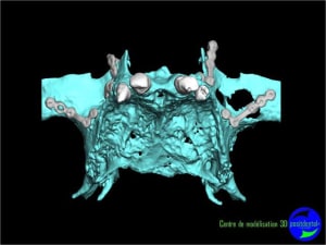 Image5 qvp6ca - Eugenol