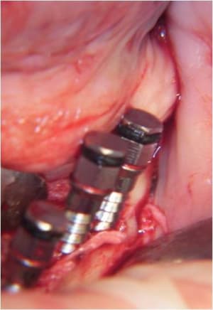 Image6 jahtja - Eugenol