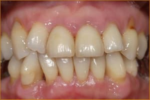 Image7 ofrmac - Eugenol