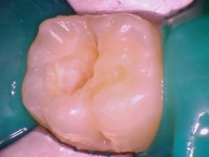 Image 003 hzzyun - Eugenol
