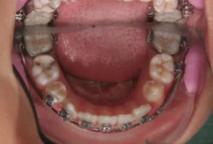 Img 5287 jddyty - Eugenol