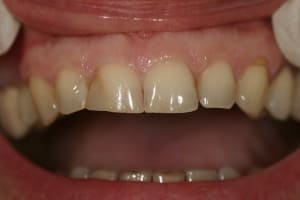 Img 9558 mviwjq - Eugenol