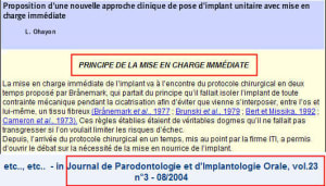 Implant pl2dxt - Eugenol