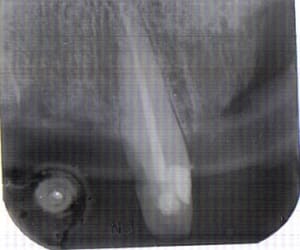 Lastscan canine floue  vzsfdq - Eugenol